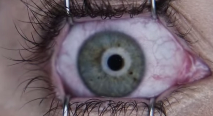 Eye Horror